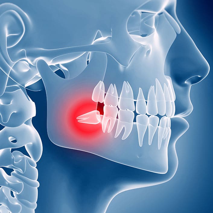 TMJ Treatment for Teeth